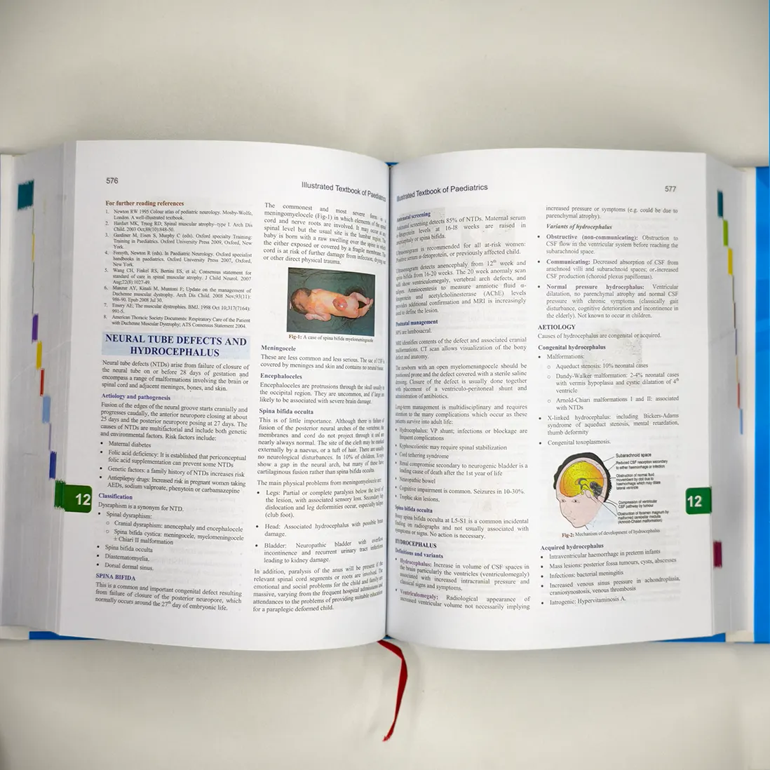 Shakur's Illustrated Textbook of Paediatrics 1st Edition - Image 4